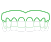 จัดฟันแบบใส (invisalign)